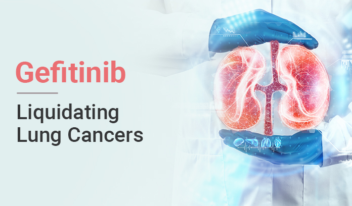 Gefitinib Lung Cancer Treatment